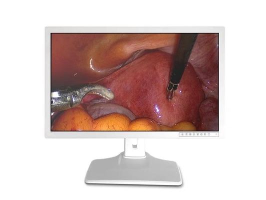 医学の内視鏡の監視テレビ32inch 3840 x 2160