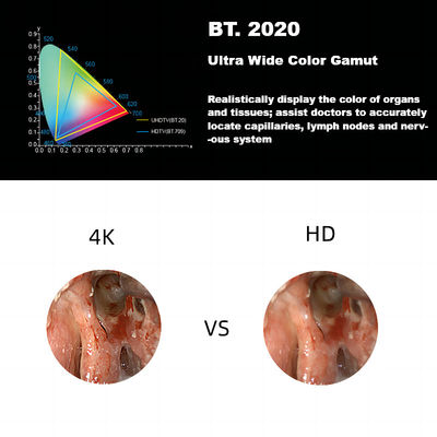 超DEC 3840A Laparoscopyのための新しい4K HDの医学の内視鏡のカメラ システム